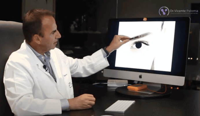 Blefaroplastia | Dr. Vicente Paloma