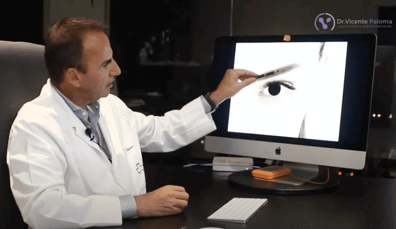 Blefaroplastia | Dr. Vicente Paloma