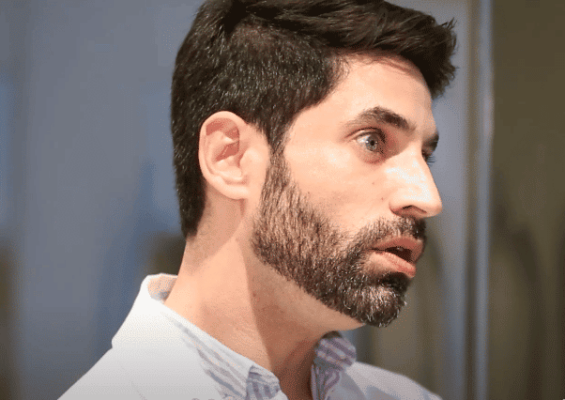 Rellenos dermicos los miedos al tratamiento