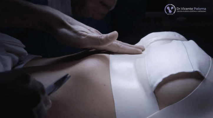 cirugía estética de mamas