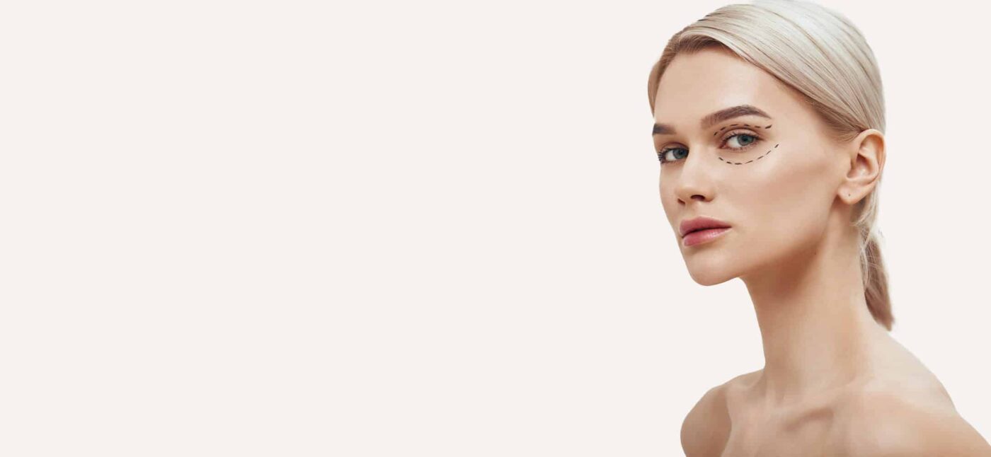 Blefaroplastia Barcelona