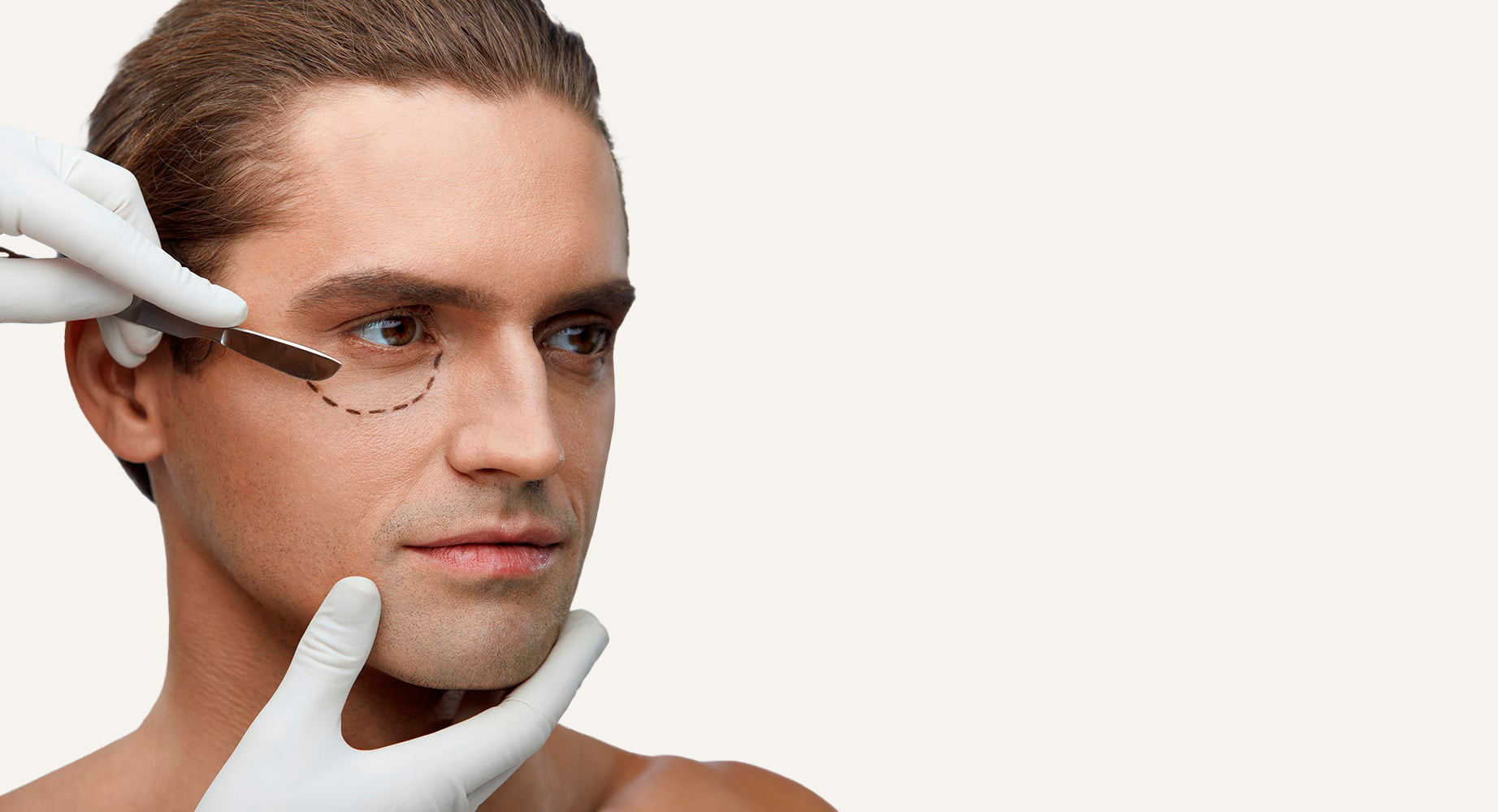 Blefaroplastia hombres