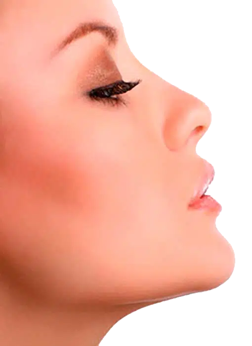 Cirugía para disminuir pómulos Barcelona.