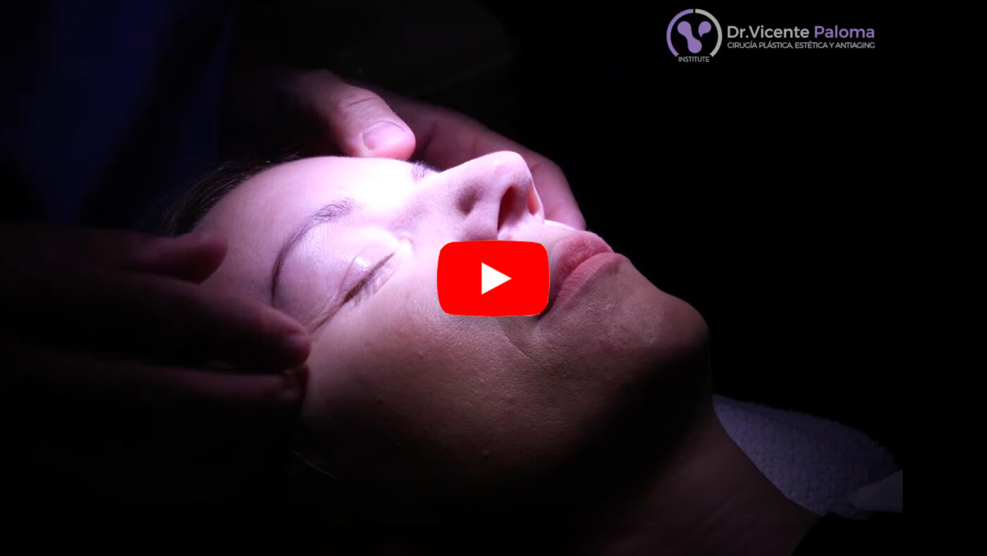 Vídeo operación en párpados superiores