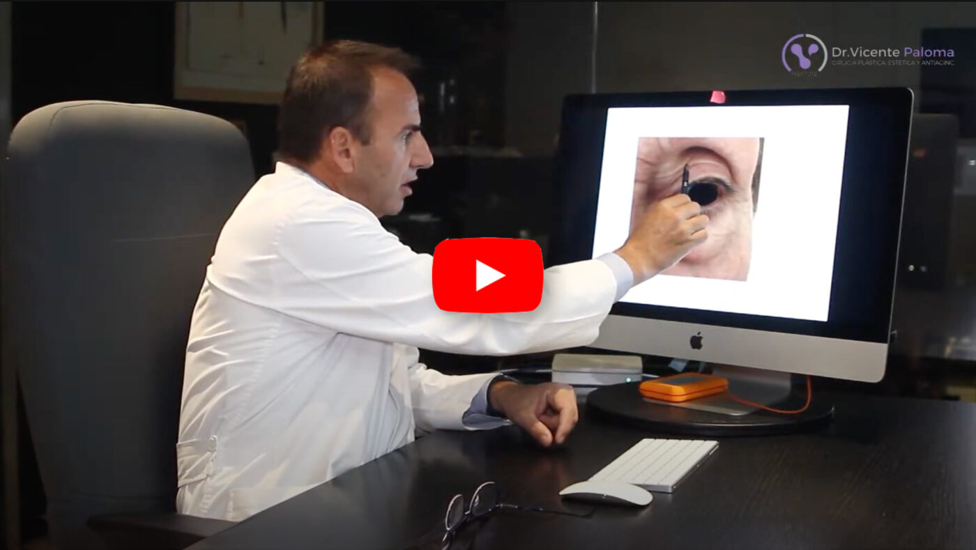 Vídeo blefaroplastia párpado superior Dr. Paloma