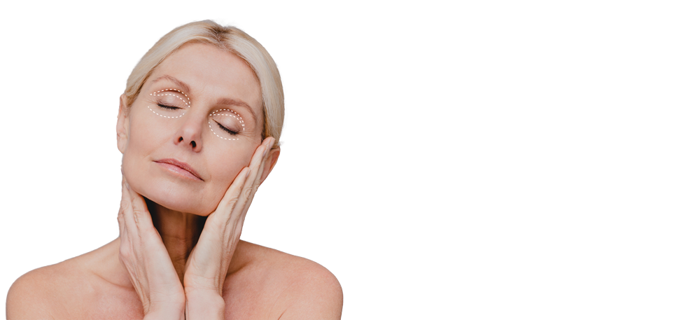 Blefaroplastia superior