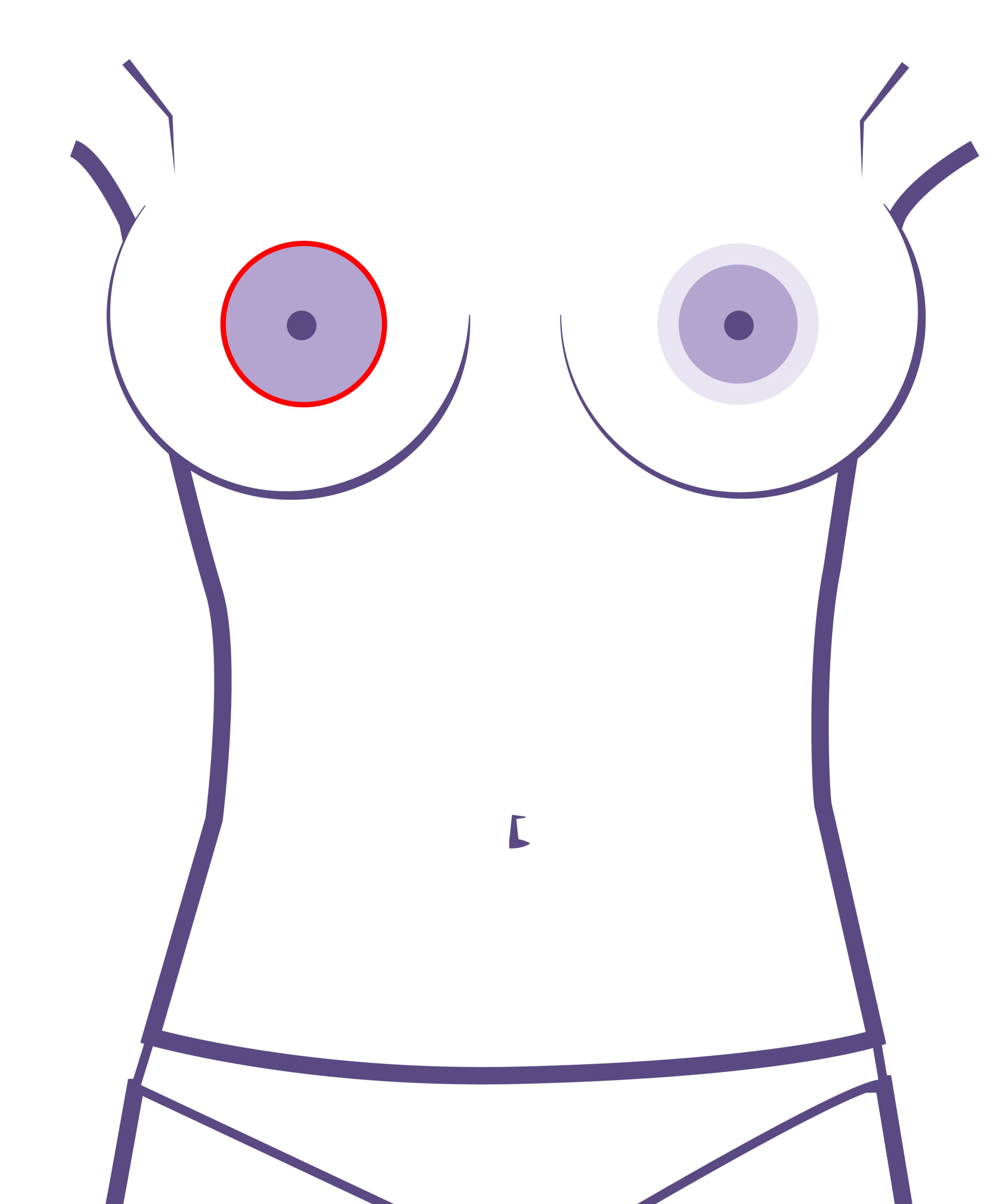 la cicatriz en la base del pezón pasa desapercibida