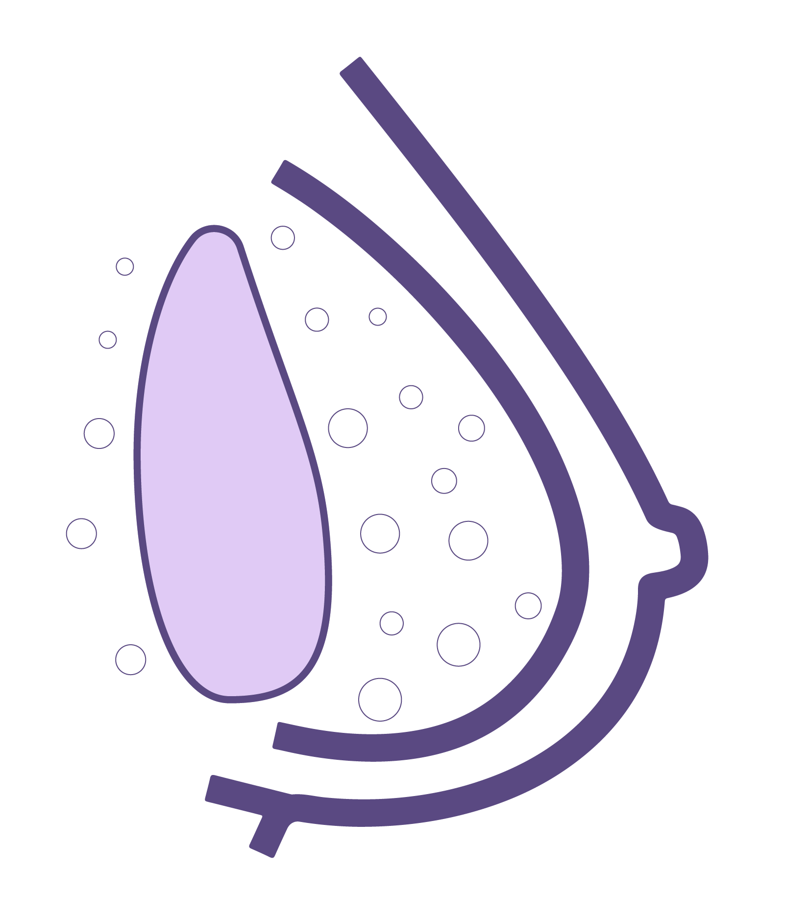 prótesis seno normal