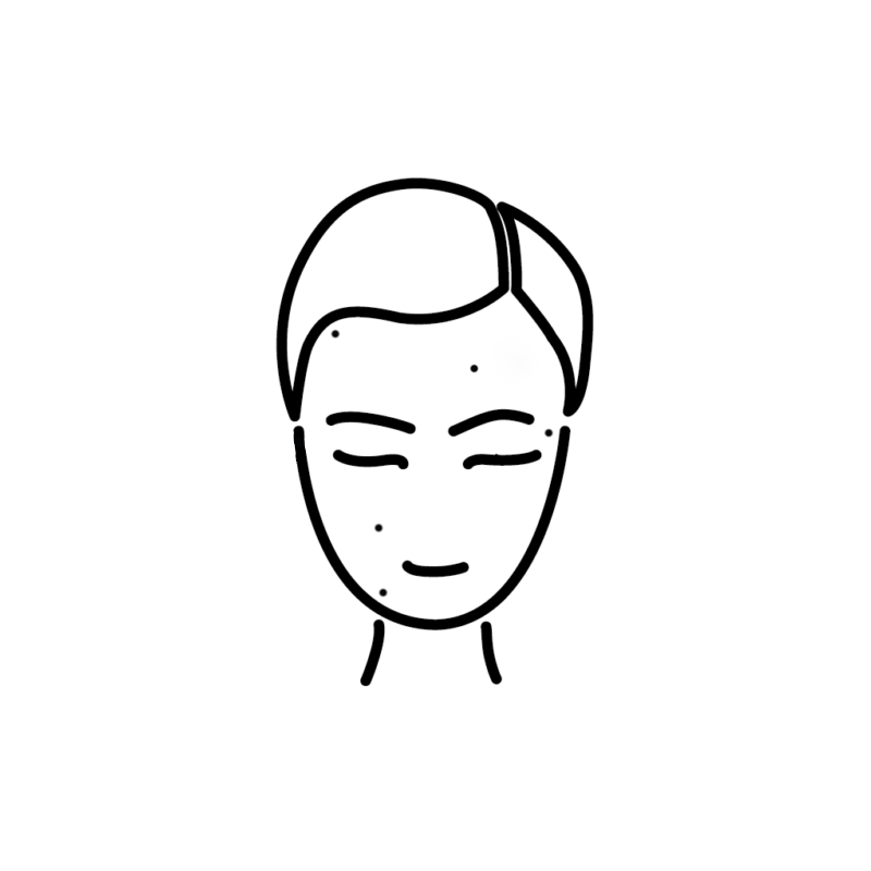 laser fraxel cicatrices acne