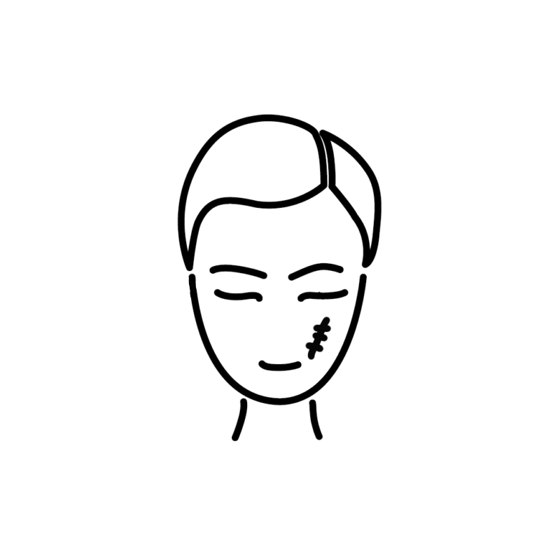 laser fraxel para cicatrices