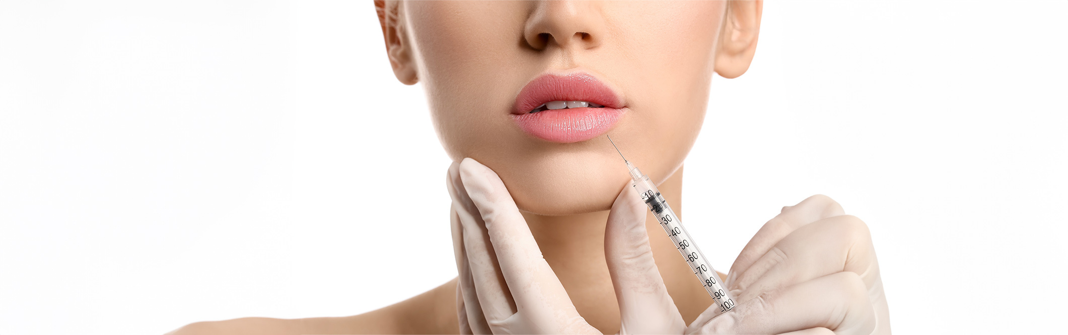 labios inyectados acido hialuronico
