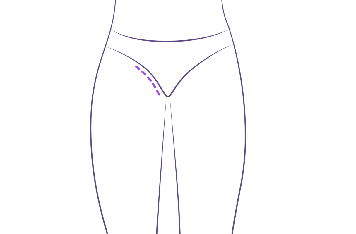 lifting de piernas cara interna de los muslos