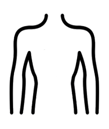 toxina botulinica hiperhidrosis axilar